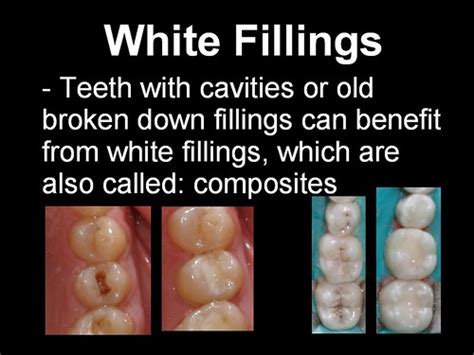 If you have a cavity between teeth, you may experience tooth sensitivity to cold, tooth sensitivity to sweets and trouble chewing due to pain or discomfort. Independence, MO Dentistry: White Fillings vs. Silver Fillings