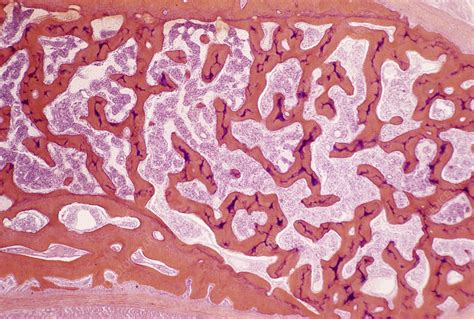 Cancellous Bone Light Micrograph Stock Image P1050193 Science