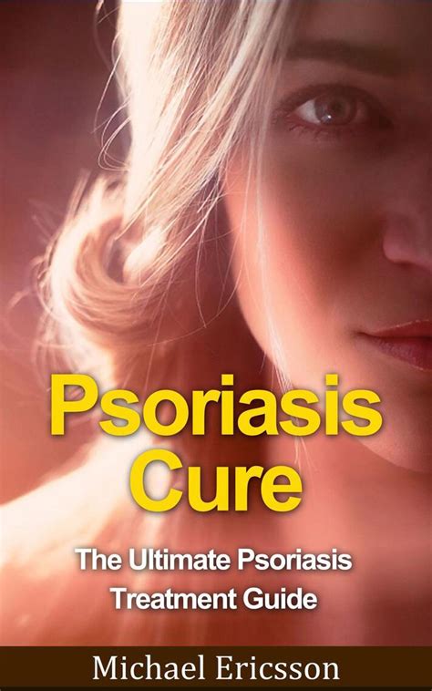 Psoriasis Cure The Ultimate Psoriasis Treatment Guide By Dr Michael
