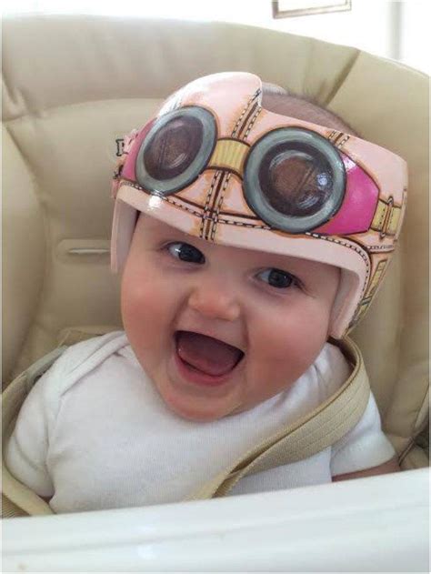 20 Cute And Fun Helmets For Babies With Plagiocephaly