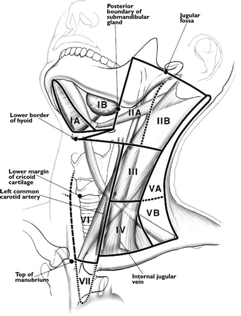 Anatomic Classification Of Lymph Nodes Springerlink