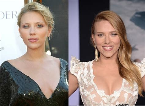 Actress scarlett johannsson has sued walt disney studios for simultaneously releasing her marvel movie 'black widow' on its streaming service and in movie theaters. Scarlett Johansson Before and After Plastic Surgery