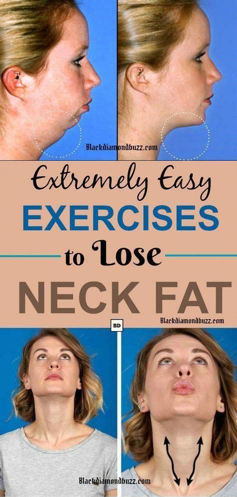 Remember that getting rid of neck fat is not something that you can achieve overnight. Pin on Weight loss inspiration / ideas