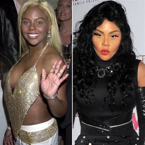 Celebritys Before And After Plastic Surgery Album On Imgur
