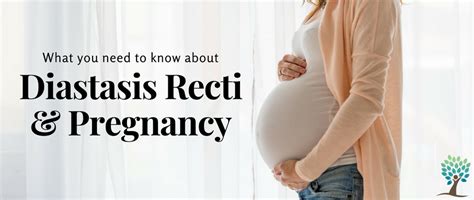 Diastasis Recti And Pregnancy What You Need To Know The Tummy Team