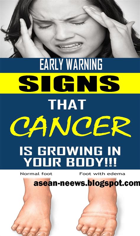 5 Early Cancer Symptoms You Shouldnt Ignore Beauty Tips