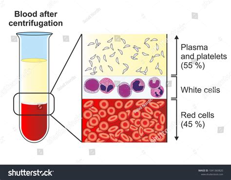 Fractionating Separating Whole Blood By Centrifuging 스톡 일러스트 1041360820