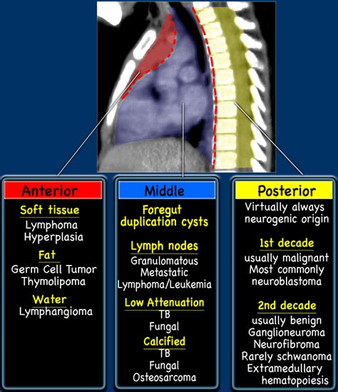 Mediastinal Tumors Radiology Pediatrics Radiology Imaging