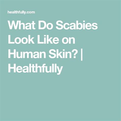 what do scabies look like on human skin healthfully scabies scabies treatment skin