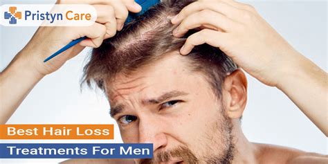 Top Image Mens Hair Loss Treatment Thptnganamst Edu Vn