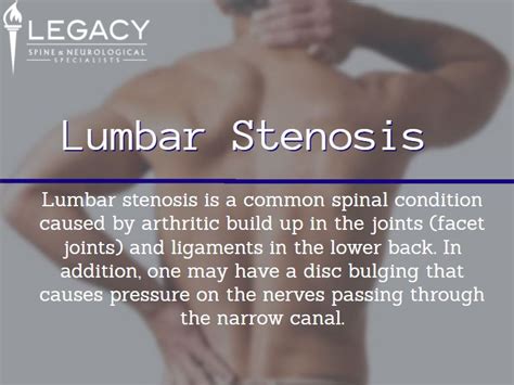 Lumbar Stenosis 0817 Legacy Spine And Neurological Specialists
