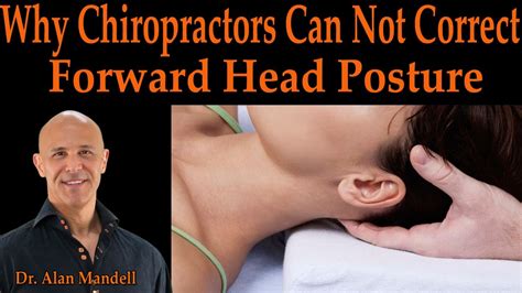 Why Chiropractors Can Not Correct Forward Head Posture Dr Mandell