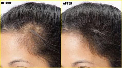 Applying the oil to your hair helps the using almond oil helps calm the overzealous sebaceous glands and helps control oil production. What are the benefits of using almond hair oil? - Quora