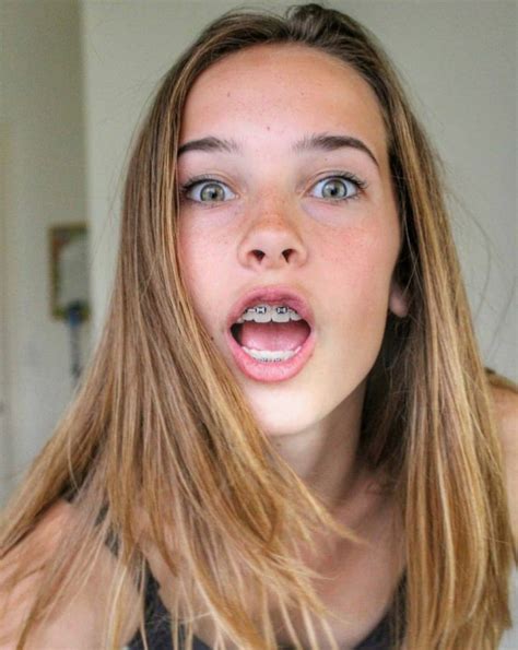 Pin By Giraffes432 On Mouth Open Cute Braces Cute Girls With Braces