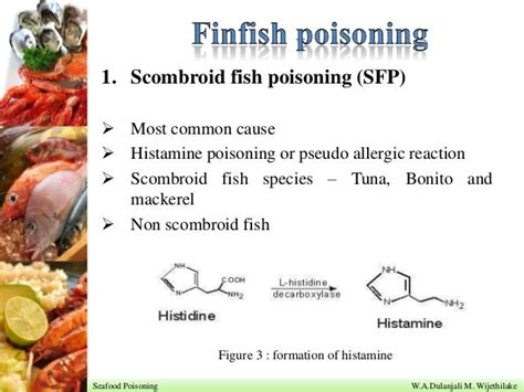 Seafood Poisoning By Dulanjali M Wijethilake