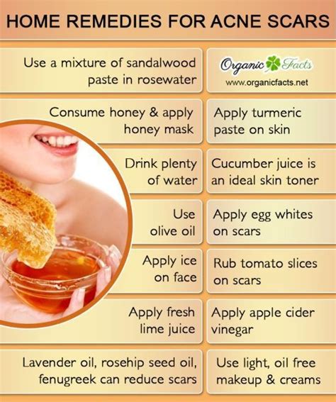 Howto How To Get Rid Of Acne Scars Home Remedies
