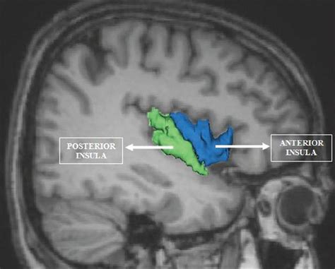 New insights link internal physiology to social behaviour. Anterior Insula and Posterior Insula | Magnetic resonance ...