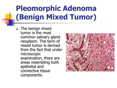 Ppt Neoplasia Powerpoint Presentation Free Download Id1384968