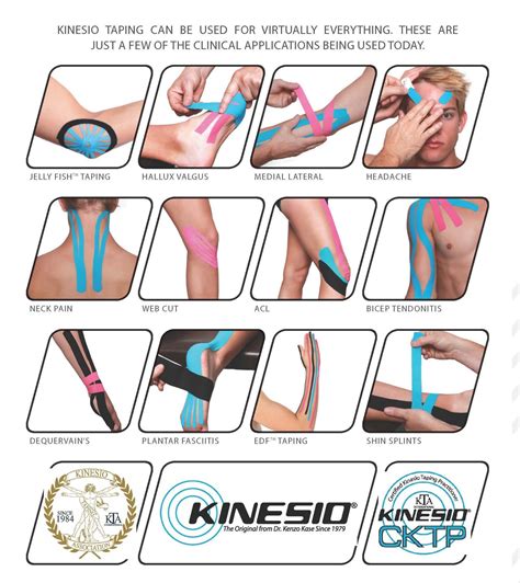 kinesio taping can be used for virtually everything these are just a few of the clinical