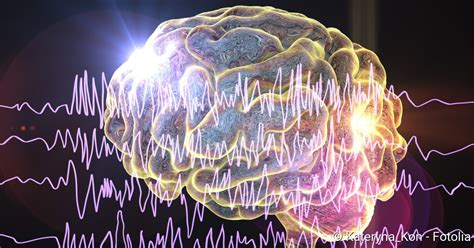 Epilepsie Definition Formen Auslöser Therapie Netdoktorch