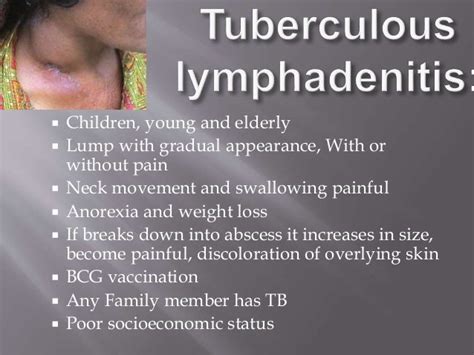 Cervical Lymphadenopathy