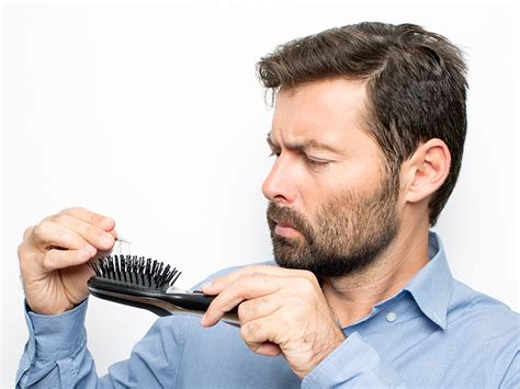 Hair will appear less thick. How Long Will An FUE Hair Transplant Last? - Toronto Hair ...