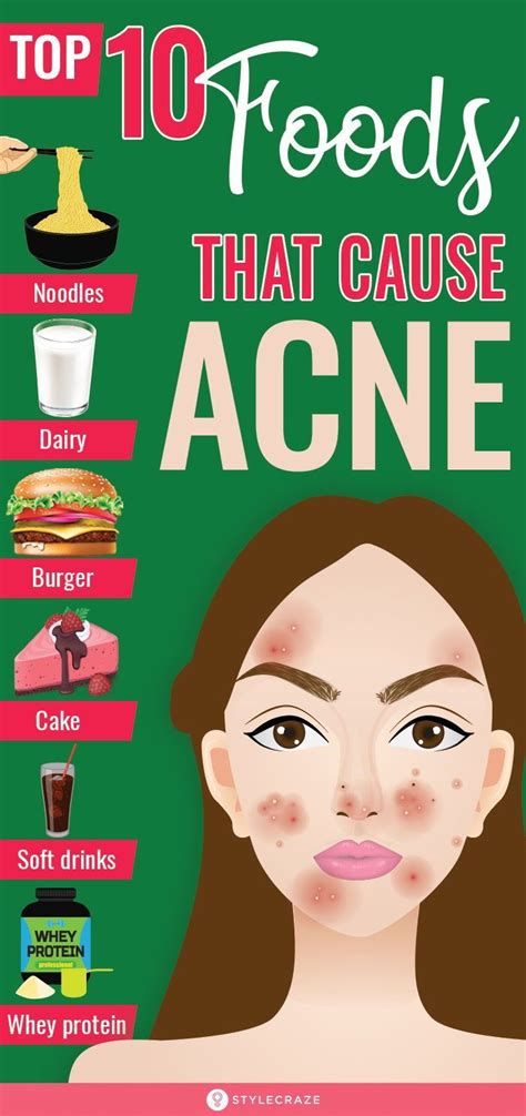 Top 10 Foods That Can Cause Acne What To Eat For Clear Skin Artofit