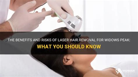 The Benefits And Risks Of Laser Hair Removal For Widows Peak What You