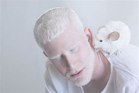 Ensaio Fotografico De Pessoas Albinas Albino Human Albinism Albino Man