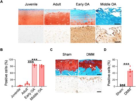 spla 2 expression in human and mouse oa cartilage a representative download scientific