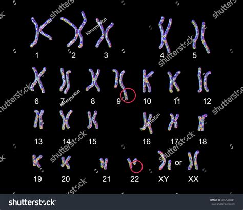 Philadelphia Chromosome Karyotype Male Female 3d Stock Illustration