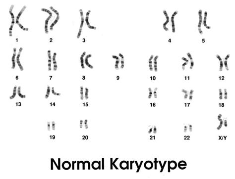 Karyotype And Karyogram