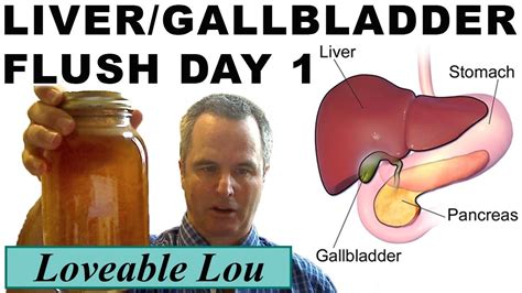 Liver And Gallbladder Flush Day 1 Youtube