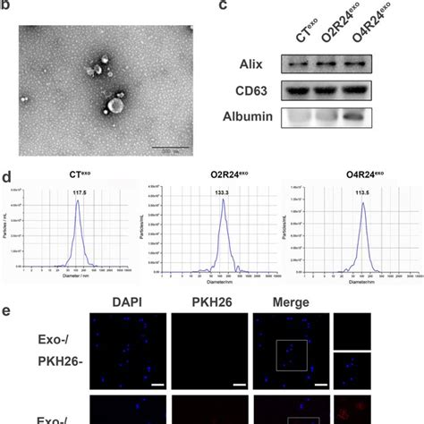 Isolation Identification And Uptake Of Exosomes A Schematic Diagram