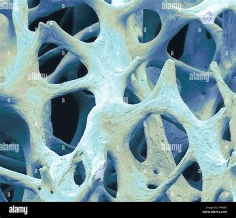 Spongy Bone Hi Res Stock Photography And Images Alamy