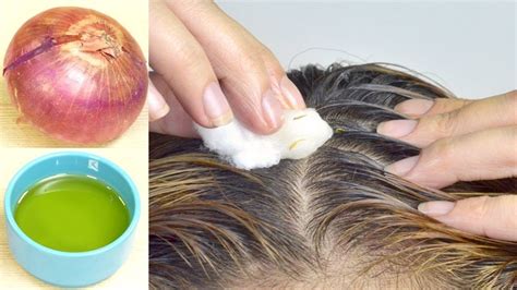 Mix With Onion To Apply Hair See What Happens Regrow Hair Naturally