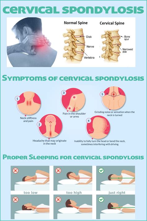 Bleeding after going through menopause; Cervical Spondylosis Symptoms, Management, and Treatment