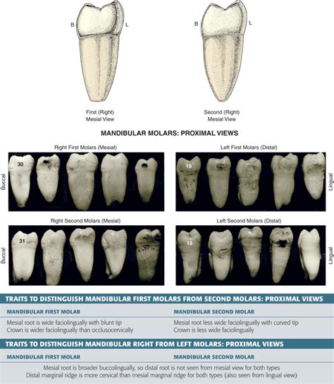 Type Traits That Differentiate Mandibular Second From First Molars