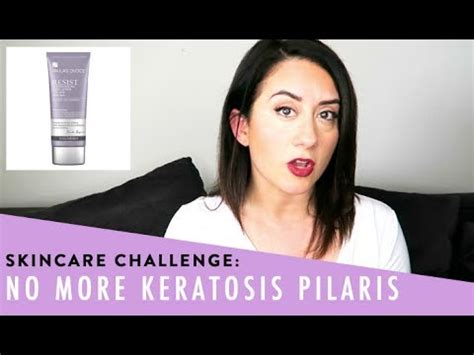 Getting Rid Of Keratosis Pilaris Day Challenge Youtube