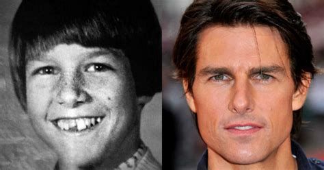 15 Ugly In Childhood Actors Turned Hot Celebs Quirkybyte