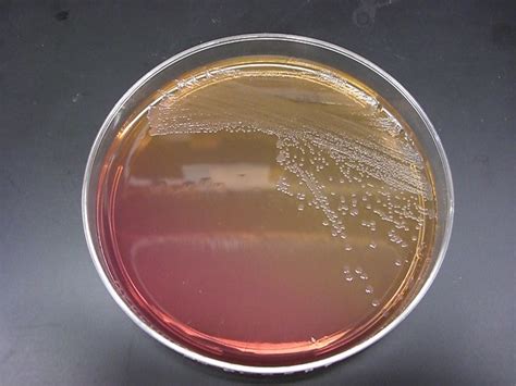 MacConkey Agar Results - an album on Flickr
