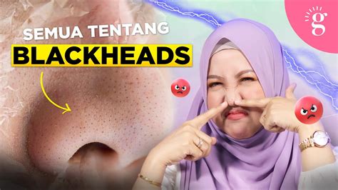 Kompilasi Video Video Glowwe 3 Blackheads And Open Comedones Youtube