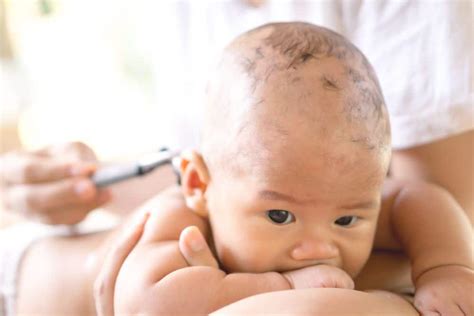 What Is Baby Hair Loss Health