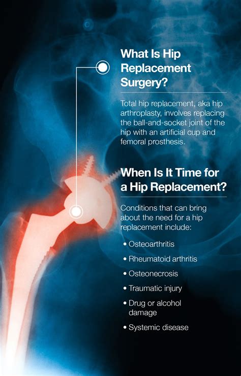 Hip Replacement Recovery How Amino Acids Make A Difference The Amino