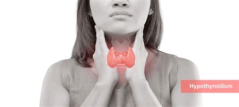 Subclinical Hypothyroidism Causes Symptoms Risk And Diagnosis