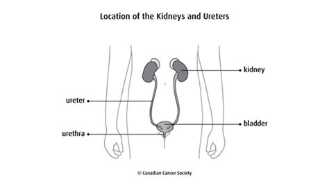 What Is Cancer Of The Renal Pelvis Or Ureter Canadian Cancer Society