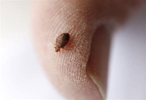 See Where Detroit Ranks On List Of Bed Bug Infested Cities