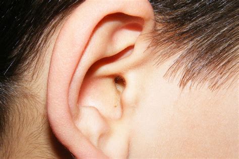 Glue Ear Healthtips By Teleme