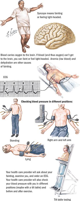 Syncope Cardiovascular Care Spectrum Health