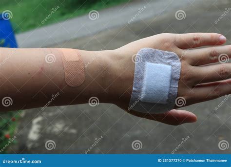 Mujer Herida De Mano Herida Accidental Herida Concepto Médico Vendaje